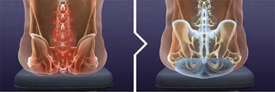BackJoy Cupping Support