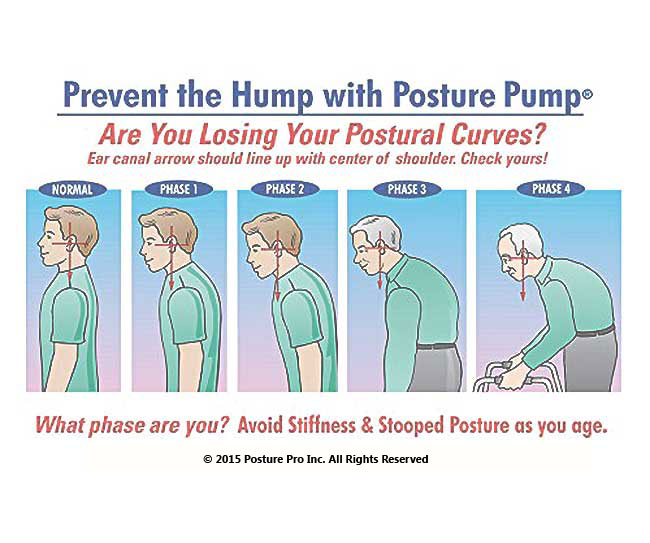 Do you have widows hump, AGS or Poor Posture?