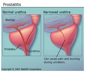 prostatitis relief seats and cushions