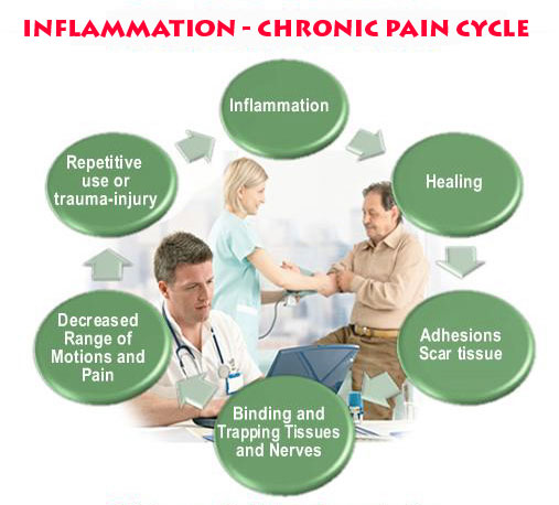 Breaking Cycle of Inflammation and Chronic Pain